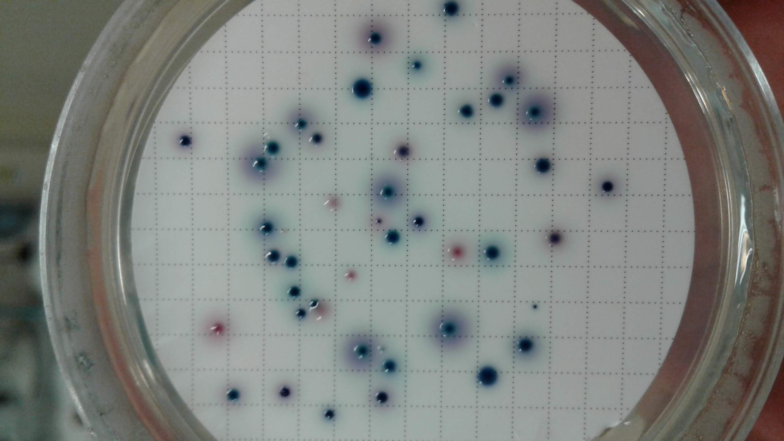 2018 E coli e coliformi lab micro