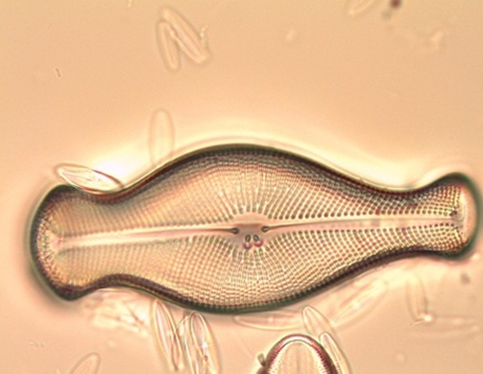 Didymosphenia geminata al microscopio