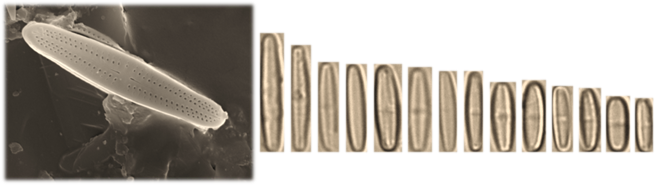 Esemplari di Achnantidium lineare osservati al microscopio ottico e elettronico (foto di UniTO)