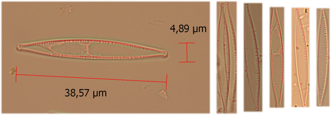 Esemplari del genere Nitzschia osservati al microscopio ottico